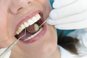 Periodontal Maintenance